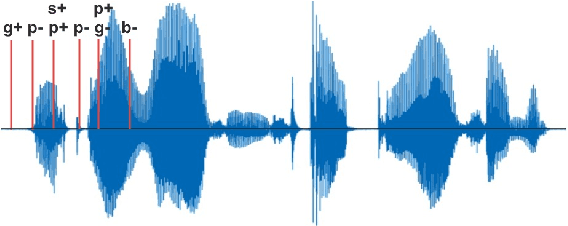 Figure 1 for When LLMs Meets Acoustic Landmarks: An Efficient Approach to Integrate Speech into Large Language Models for Depression Detection