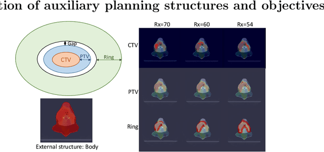 Figure 2 for Automating proton PBS treatment planning for head and neck cancers using policy gradient-based deep reinforcement learning