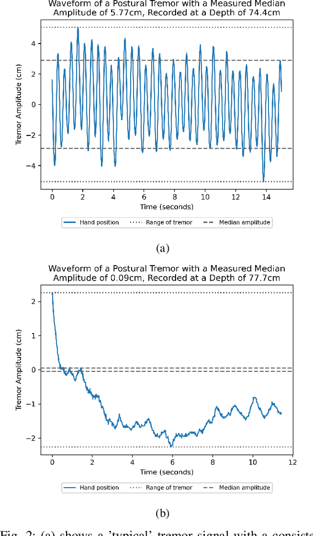 Figure 2 for Contactless hand tremor amplitude measurement using smartphones: development and pilot evaluation