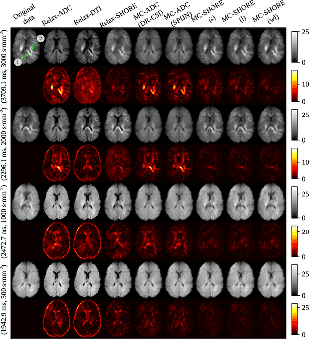 Figure 3 for Multi-compartment diffusion-relaxation MR signal representation in the spherical 3D-SHORE basis