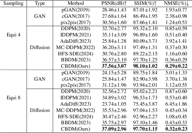 Figure 4 for Cycle-Consistent Bridge Diffusion Model for Accelerated MRI Reconstruction