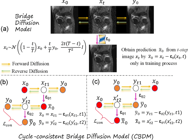 Figure 3 for Cycle-Consistent Bridge Diffusion Model for Accelerated MRI Reconstruction