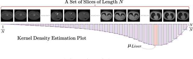 Figure 1 for TP-UNet: Temporal Prompt Guided UNet for Medical Image Segmentation