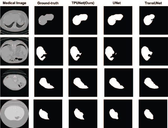 Figure 3 for TP-UNet: Temporal Prompt Guided UNet for Medical Image Segmentation