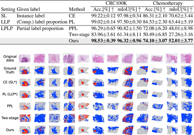 Figure 4 for Learning from Partial Label Proportions for Whole Slide Image Segmentation