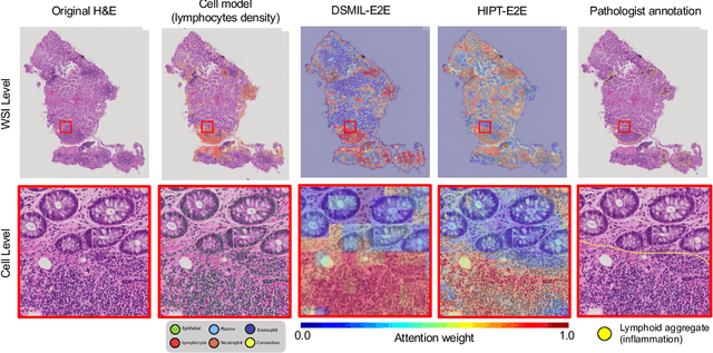 Figure 3 for Interpretable histopathology-based prediction of disease relevant features in Inflammatory Bowel Disease biopsies using weakly-supervised deep learning