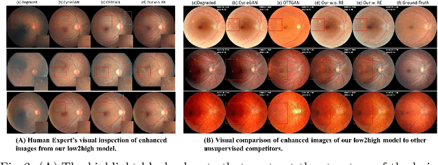 Figure 3 for OTRE: Where Optimal Transport Guided Unpaired Image-to-Image Translation Meets Regularization by Enhancing