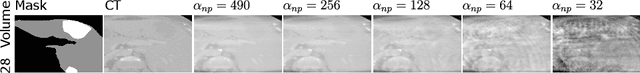 Figure 2 for Initial Study On Improving Segmentation By Combining Preoperative CT And Intraoperative CBCT Using Synthetic Data