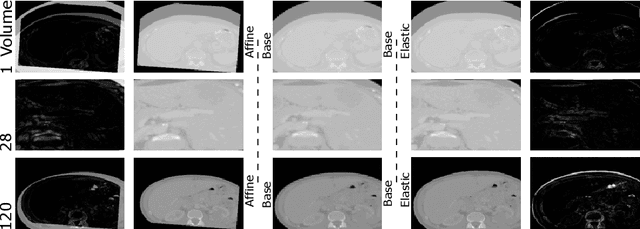 Figure 3 for Initial Study On Improving Segmentation By Combining Preoperative CT And Intraoperative CBCT Using Synthetic Data