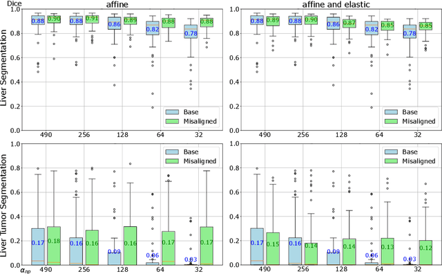 Figure 4 for Initial Study On Improving Segmentation By Combining Preoperative CT And Intraoperative CBCT Using Synthetic Data