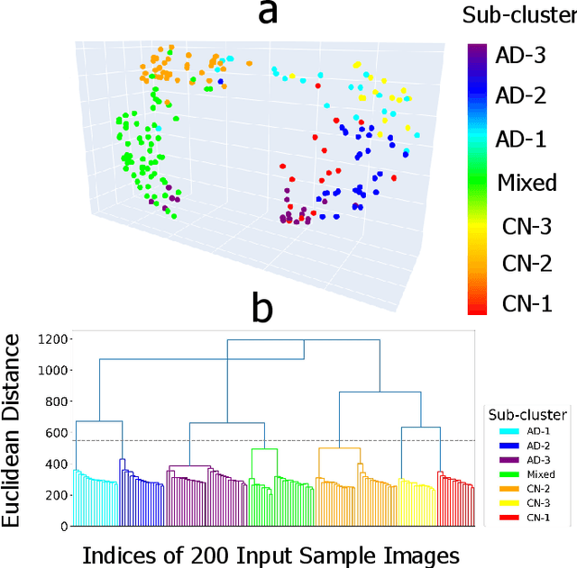 Figure 3 for LAVA: Granular Neuron-Level Explainable AI for Alzheimer's Disease Assessment from Fundus Images