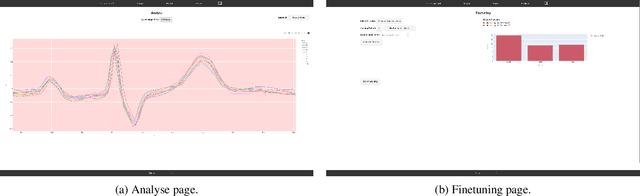 Figure 1 for ExChanGeAI: An End-to-End Platform and Efficient Foundation Model for Electrocardiogram Analysis and Fine-tuning
