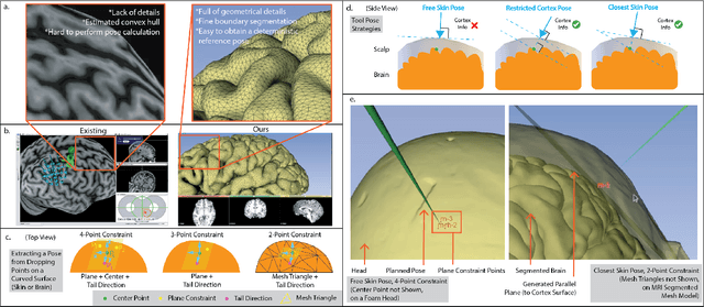 Figure 1 for An Image-Guided Robotic System for Transcranial Magnetic Stimulation: System Development and Experimental Evaluation