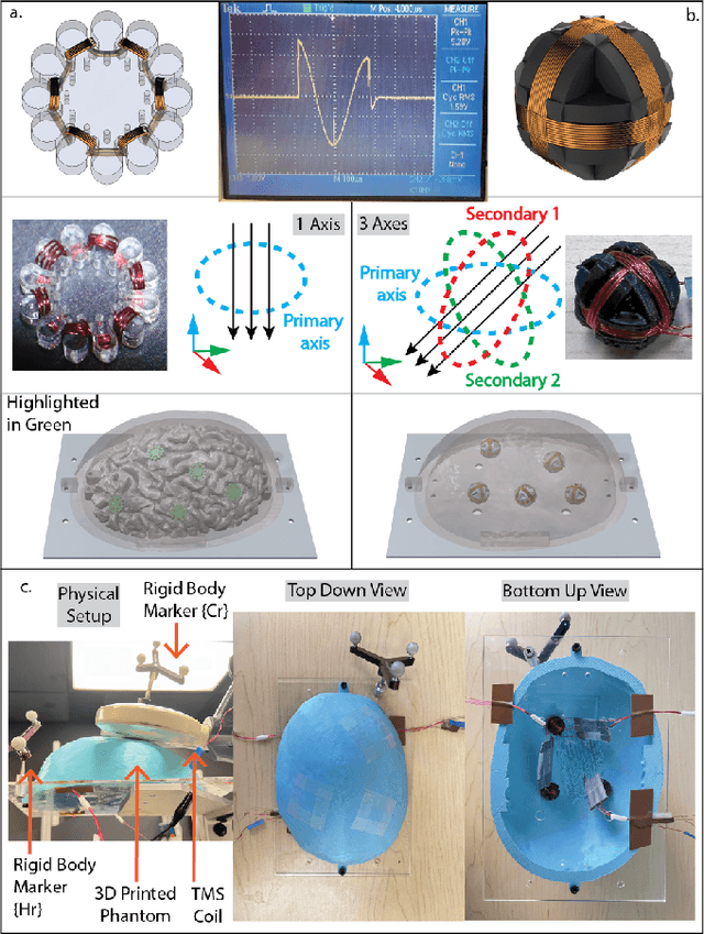 Figure 3 for An Image-Guided Robotic System for Transcranial Magnetic Stimulation: System Development and Experimental Evaluation