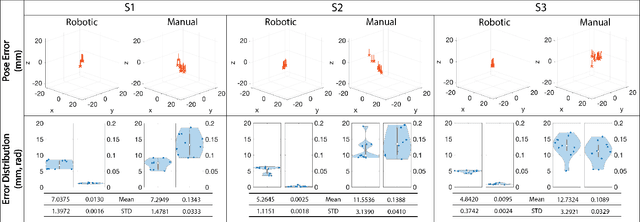 Figure 4 for An Image-Guided Robotic System for Transcranial Magnetic Stimulation: System Development and Experimental Evaluation