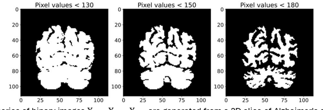 Figure 1 for 3D-TDA -- Topological feature extraction from 3D images for Alzheimer's disease classification