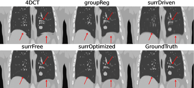 Figure 3 for Resolving Variable Respiratory Motion From Unsorted 4D Computed Tomography