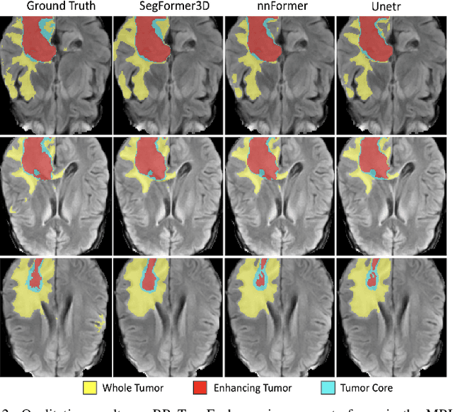 Figure 4 for SegFormer3D: an Efficient Transformer for 3D Medical Image Segmentation