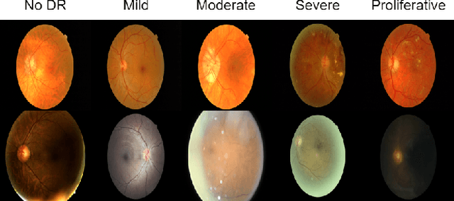 Figure 1 for Generalizing Across Domains in Diabetic Retinopathy via Variational Autoencoders