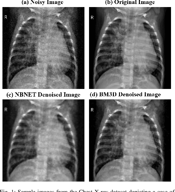 Figure 1 for Evaluating BM3D and NBNet: A Comprehensive Study of Image Denoising Across Multiple Datasets