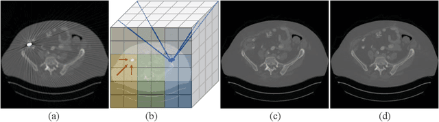 Figure 1 for Dense Transformer based Enhanced Coding Network for Unsupervised Metal Artifact Reduction