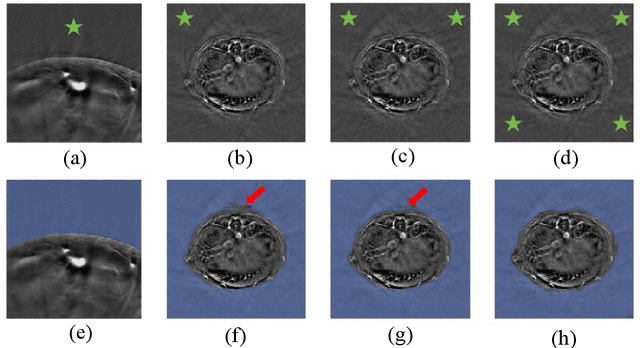 Figure 2 for Streamlined Photoacoustic Image Processing with Foundation Models: A Training-Free Solution