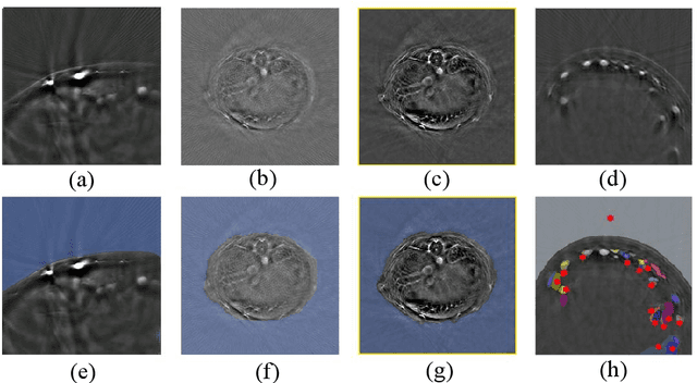 Figure 3 for Streamlined Photoacoustic Image Processing with Foundation Models: A Training-Free Solution