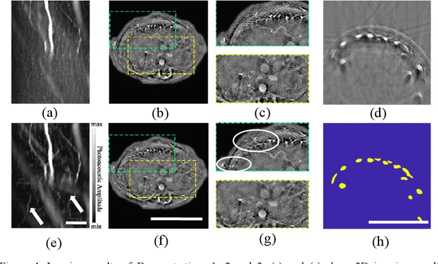 Figure 4 for Streamlined Photoacoustic Image Processing with Foundation Models: A Training-Free Solution