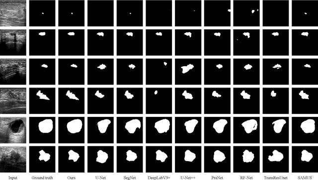 Figure 4 for Ultrasound SAM Adapter: Adapting SAM for Breast Lesion Segmentation in Ultrasound Images