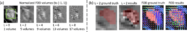 Figure 3 for Diffusion Model-based FOD Restoration from High Distortion in dMRI
