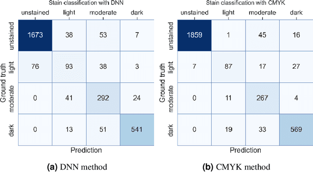 Figure 2 for Development and Validation of Fully Automatic Deep Learning-Based Algorithms for Immunohistochemistry Reporting of Invasive Breast Ductal Carcinoma