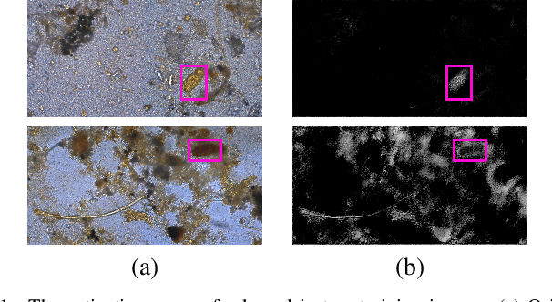 Figure 1 for A Flyweight CNN with Adaptive Decoder for Schistosoma mansoni Egg Detection