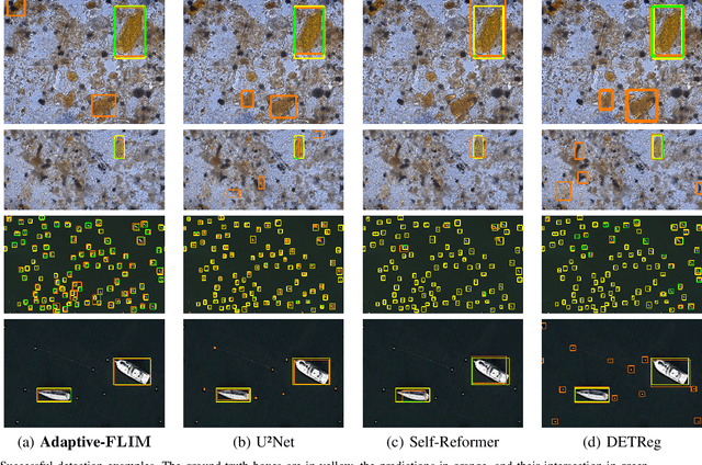 Figure 3 for A Flyweight CNN with Adaptive Decoder for Schistosoma mansoni Egg Detection