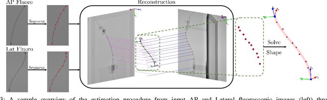 Figure 3 for Fluoroscopic Shape and Pose Tracking of Catheters with Custom Radiopaque Markers