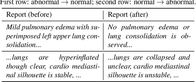 Figure 1 for PairAug: What Can Augmented Image-Text Pairs Do for Radiology?