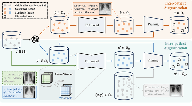 Figure 2 for PairAug: What Can Augmented Image-Text Pairs Do for Radiology?