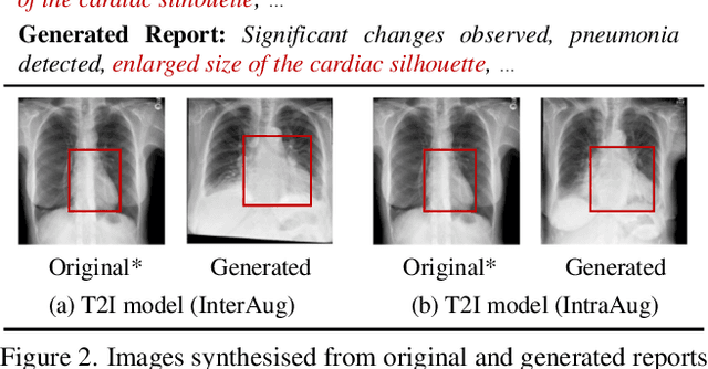 Figure 3 for PairAug: What Can Augmented Image-Text Pairs Do for Radiology?