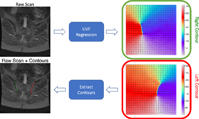 Figure 1 for Contouring by Unit Vector Field Regression