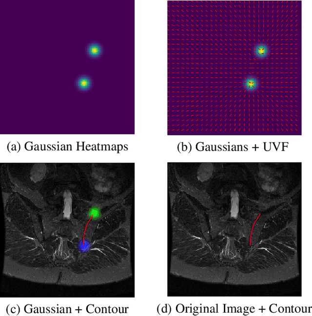 Figure 4 for Contouring by Unit Vector Field Regression