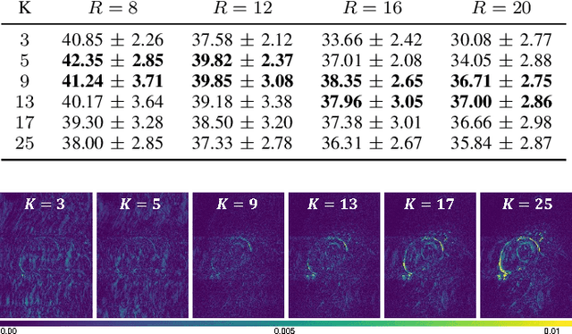 Figure 3 for Reconstruction-driven motion estimation for motion-compensated MR CINE imaging