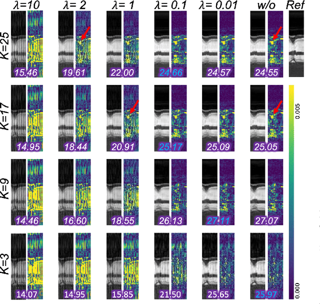 Figure 4 for Reconstruction-driven motion estimation for motion-compensated MR CINE imaging