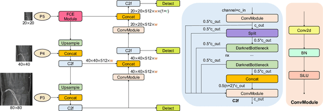 Figure 3 for FCE-YOLOv8: YOLOv8 with Feature Context Excitation Modules for Fracture Detection in Pediatric Wrist X-ray Images