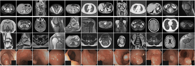 Figure 3 for RadImageGAN -- A Multi-modal Dataset-Scale Generative AI for Medical Imaging