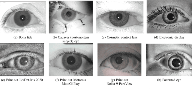 Figure 1 for Towards Iris Presentation Attack Detection with Foundation Models