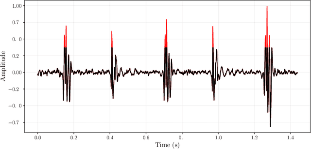 Figure 2 for FunnelNet: An End-to-End Deep Learning Framework to Monitor Digital Heart Murmur in Real-Time