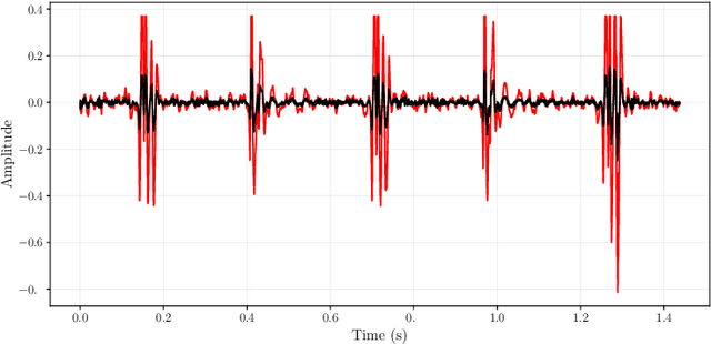 Figure 3 for FunnelNet: An End-to-End Deep Learning Framework to Monitor Digital Heart Murmur in Real-Time