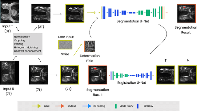 Figure 2 for Variational U-Net with Local Alignment for Joint Tumor Extraction and Registration (VALOR-Net) of Breast MRI Data Acquired at Two Different Field Strengths