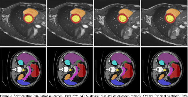 Figure 3 for MIST: Medical Image Segmentation Transformer with Convolutional Attention Mixing (CAM) Decoder
