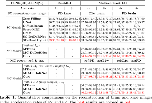 Figure 2 for DuDoUniNeXt: Dual-domain unified hybrid model for single and multi-contrast undersampled MRI reconstruction