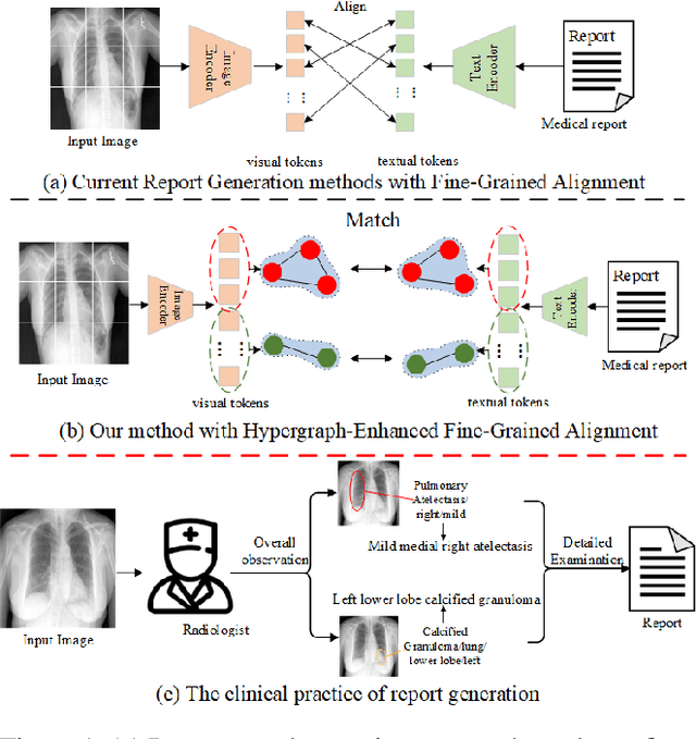 Figure 1 for DAMPER: A Dual-Stage Medical Report Generation Framework with Coarse-Grained MeSH Alignment and Fine-Grained Hypergraph Matching